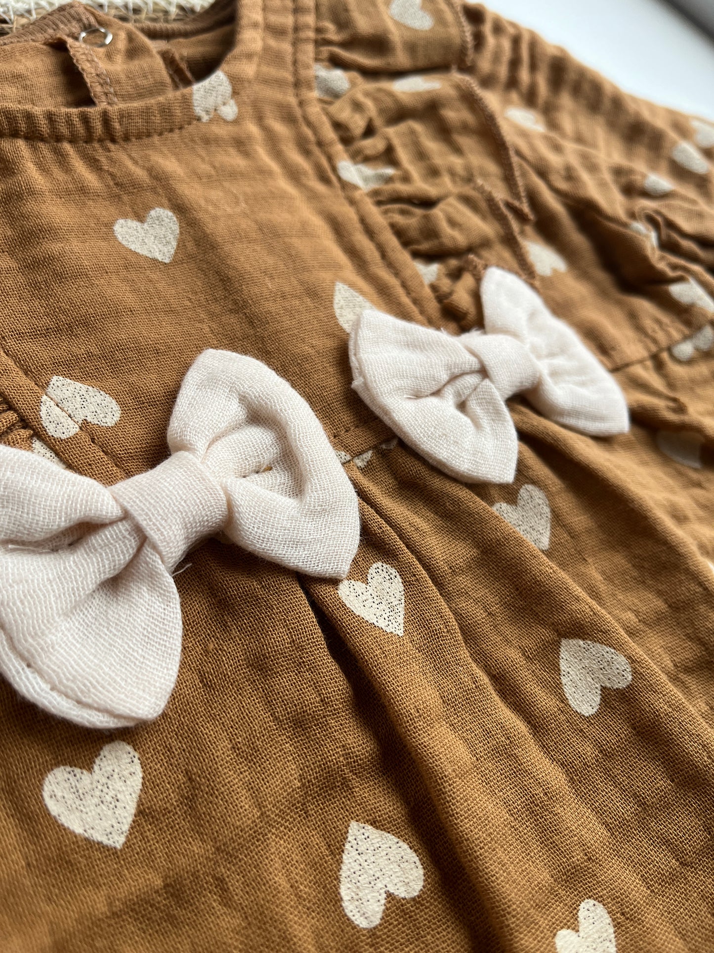 Бебешки гащеризон